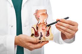 Anal Disorder Treatment